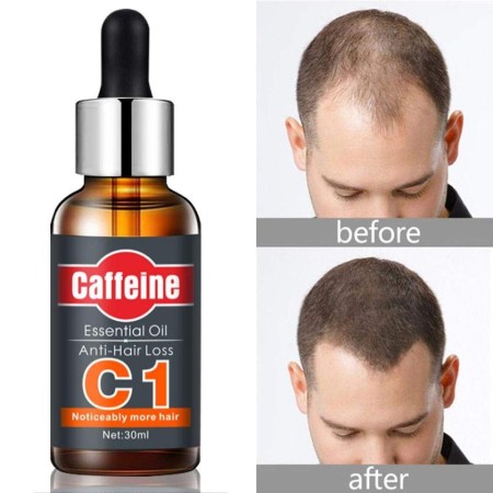 Caffeine Essential Oil Anti Hair Loss 30ml